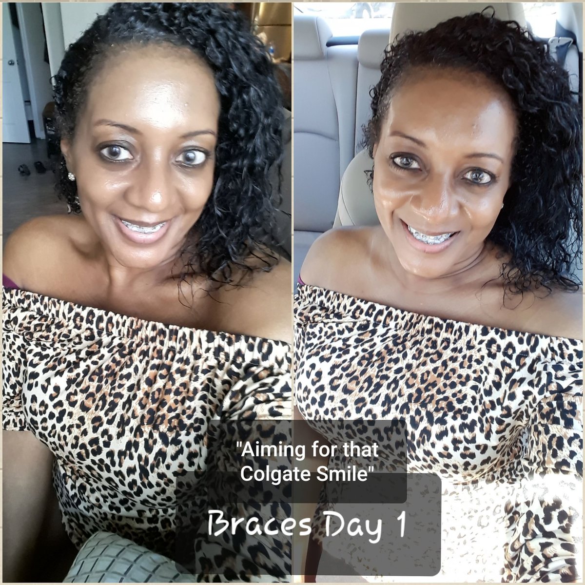 You're never too old to get braces. I'm Aiming for that Colgate Smile! Braces Day 1... #braces #adultbraces #dentist #orthodontist #teeth #smile #colgatesmile #traditionalbraces #metalbraces #oralhealth #health #orthodontics #igotbraces #dental #tooth #clearbraces #ceramicbraces