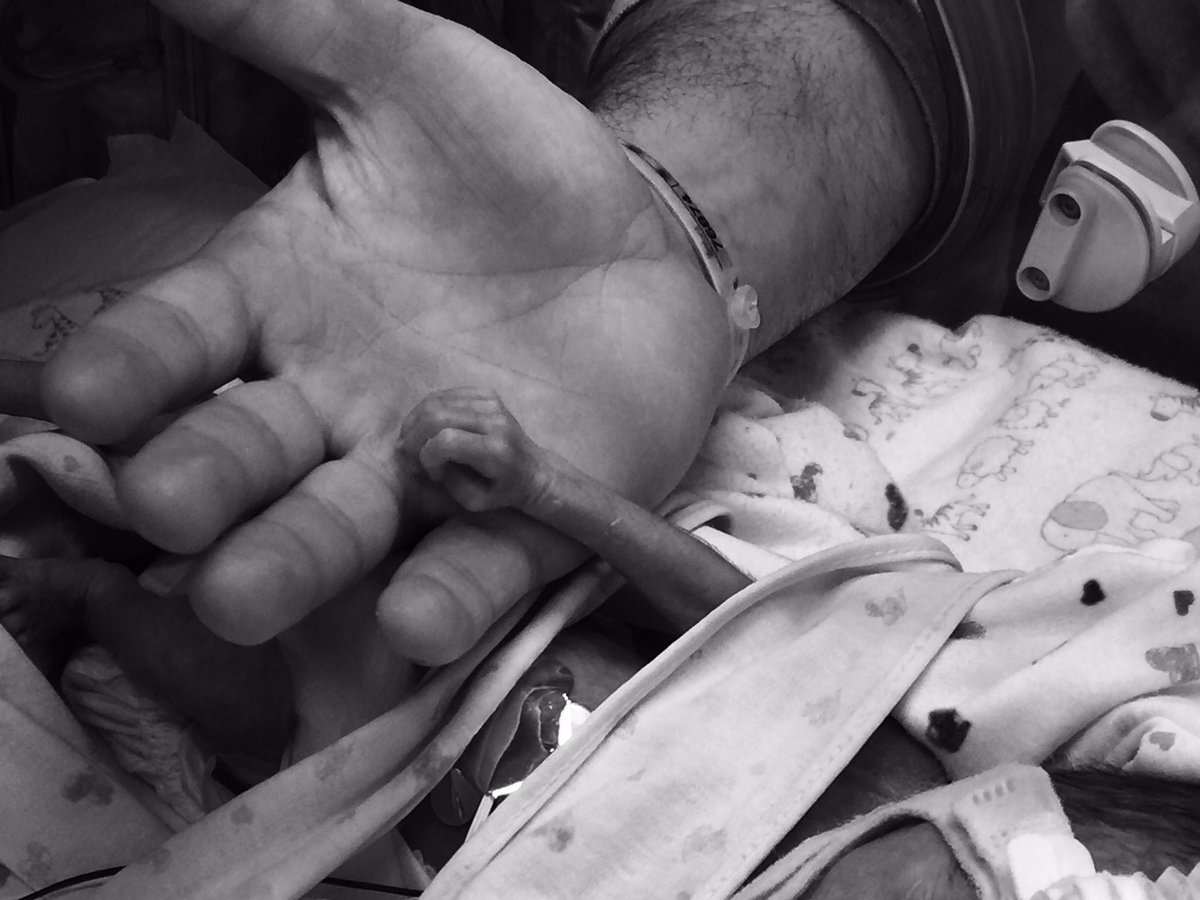 fromminitomoose's tweet photo. #Tbt of #maddiemoose who was born at #27weeks and is now #three Our #littlewarriors amaze us everyday! #NICU #nicubaby #nicucommunity #preemie #preemiebaby https://t.co/KuMxFbFvBE