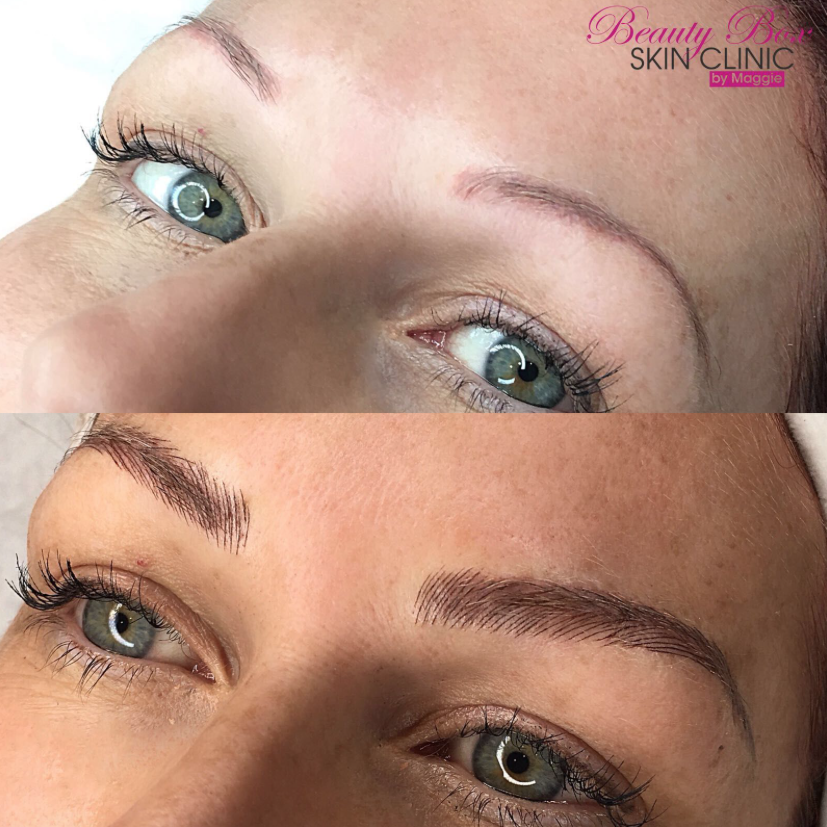 BeautyBoxMaggie's tweet photo. The transformation😍👌

Microblading will give you the natural and defined brows you want✨

Call Maggie on 07424716505 to book an appointment!

#browgoals #microblading #eyebrows #Essex https://t.co/jw2Gwow4gf
