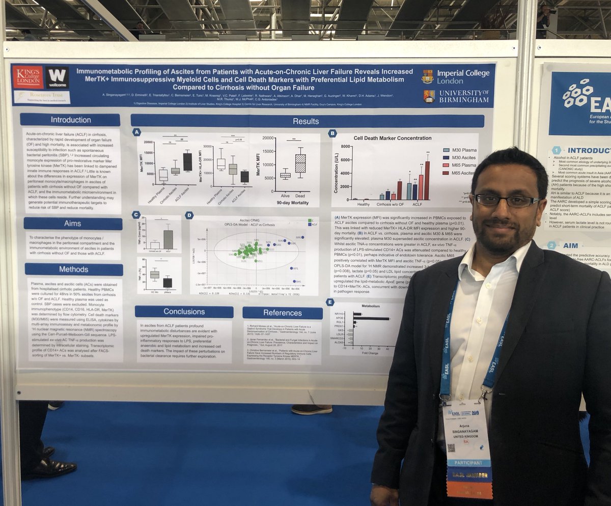 Imperial Hepatology (@ihepatology) on Twitter photo Dr A. Singanayagam <a href="/arjybargy/">Arj Singanayagam</a> from <a href="/IHepatology/">Imperial Hepatology</a> presenting his work on “Immunometabolic profiling of ascites in ACLF patients”; check it out on THU-052 <a href="/EASLnews/">EASLnews</a> #ILC2019 #ACLF #liverdisease #macrophages Dr A. Singanayagam <a href="/arjybargy/">Arj Singanayagam</a> from <a href="/IHepatology/">Imperial Hepatology</a> presenting his work on “Immunometabolic profiling of ascites in ACLF patients”; check it out on THU-052 <a href="/EASLnews/">EASLnews</a> #ILC2019 #ACLF #liverdisease #macrophages