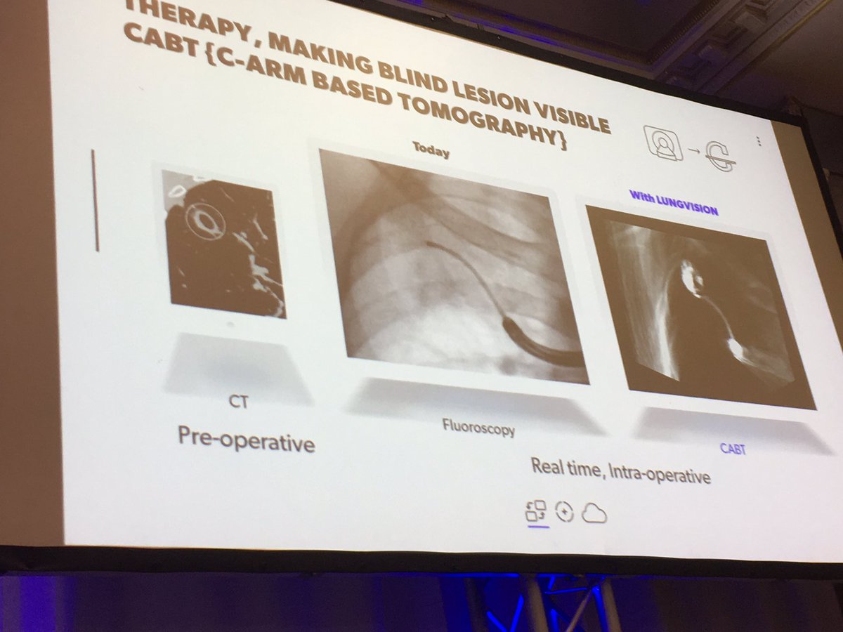 MedTechStrat's tweet photo. #BodyVisionMedical’s vision: a world without #lungcancer - CEO #DorianAverbuch presenting now at #InnovationDublin19 on their #LUNGVISION system for real-time guidance to early-stage #lung lesions https://t.co/Leje4ZKExq https://t.co/wnDpgGjv4E