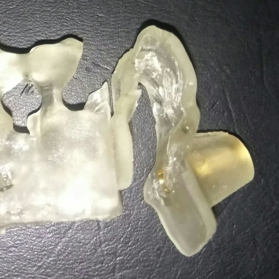 MM3D_'s tweet photo. Personalized surgical guide to improve surgical intervention.
#planificaciónquirúrgica #guiaquirurgica #dentist #dentalschool #3DPrinting #medicalmodel3d #custom #surgeryplanning https://t.co/IW8iDMJPOO
