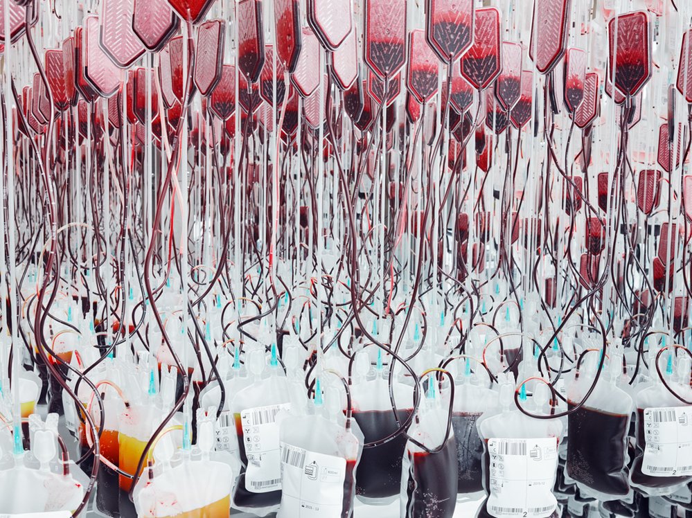 KindaSquirrelly's tweet photo. #ThingsImAddictedTo
Blood.
(sorry) https://t.co/QvaDMf5fqX