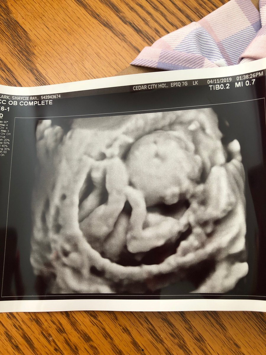 MorrisonGage's tweet photo. Couldn’t be more thankful to be having a little girl!! Already love her to pieces!!💗 https://t.co/rbkQGmcKv5