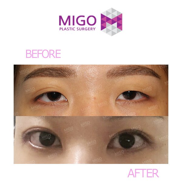 แฮชแท ก 眠そうな目 ในทว ตเตอร แฮชแท ก 眠そうな目 ในทว ตเตอร