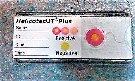 stevenbollipo's tweet photo. With the urease test, I get quite a few positives in cirrhosis patients. Is it possible to get a false positive result of urease based test because of blood ammonia level in the tissue? #helicobacter #cirrhosis #ammonia #CLOtest @JasmohanBajaj @AmulyaNagarurMD @renumathyd https://t.co/nsaSZdeTKS