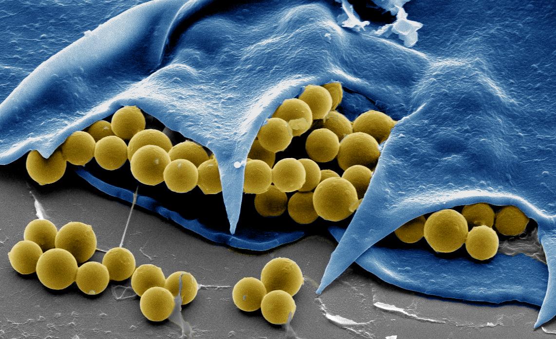 AdvPortfolio's tweet photo. Rotibot: a self-propelling microcleaner for water decontamination whose operation can be scaled-up to realistic aqueous environmental settings. #microbeads #biohybrid @NANO_UCSD
Read more in https://t.co/pt58R28PRe https://t.co/pSjlqOfjrc