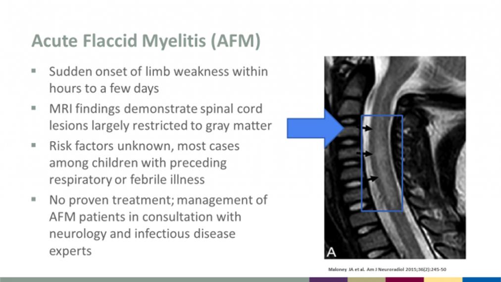 RodneyRohde's tweet photo. Looking forward to sharing a Review on #AcuteFlaccidMyelitis #AFM this morning at the #TACLS2019 Get on Board Conference in @cityofcc Corpus Christi! AFM is a bit of a mystery but most likely linked to Enterovirus D68 #EVD68 

What do you know about the #MedicalLaboratory? https://t.co/fol71qX26R