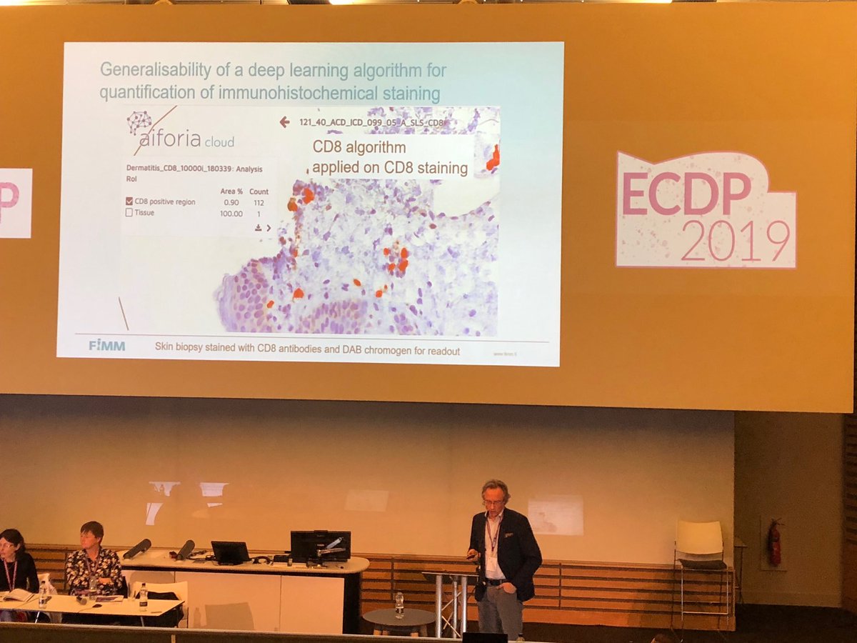 kaisa_helminen's tweet photo. Professor Johan Lundin raises important topics to consider when developing deep learning algorithms and highlights the potential to create generalisable AI algorithms. #ECDP2019 @FIMM_UH #aiforiacreate https://t.co/Nwrlq8FbHp