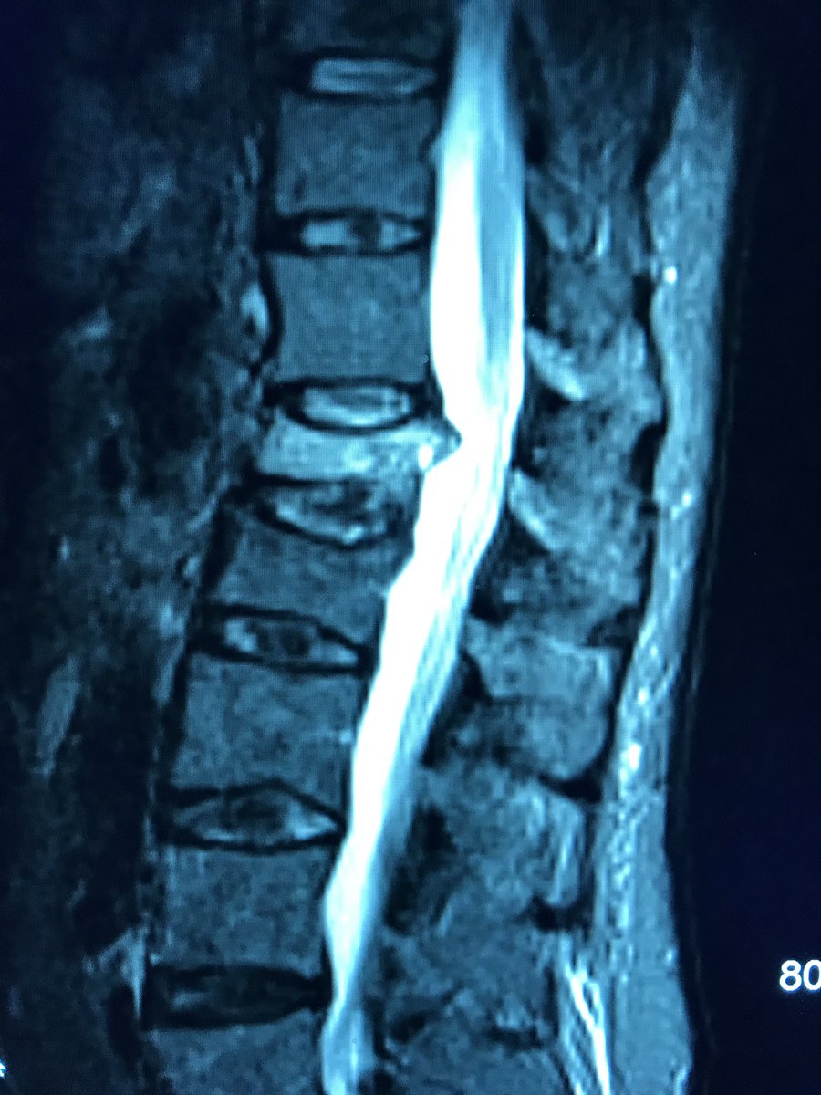 Marshall Walker, MD, MPH tweet media