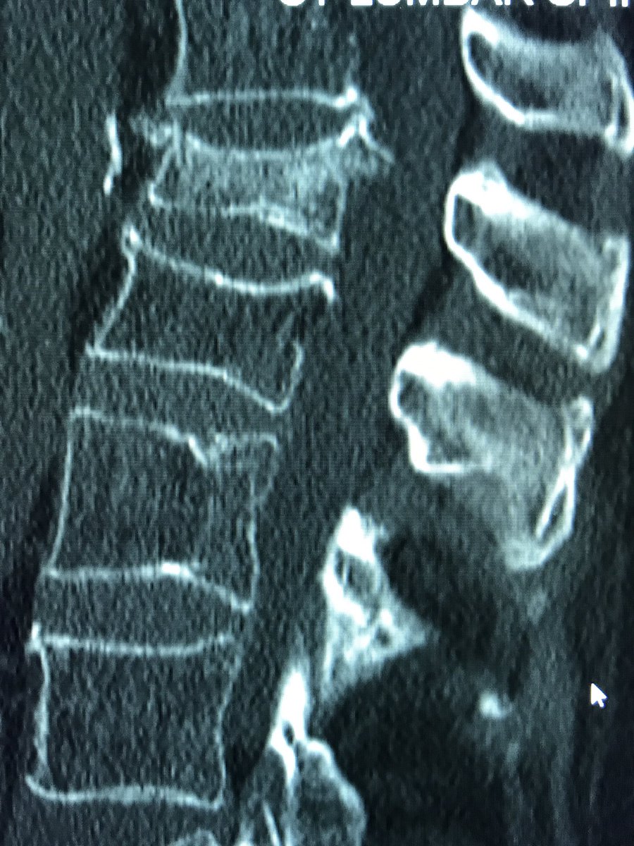 Marshall Walker, MD, MPH tweet media