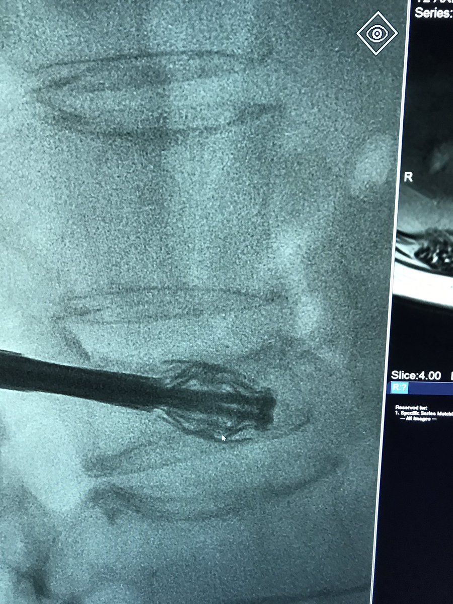 Marshall Walker, MD, MPH tweet media