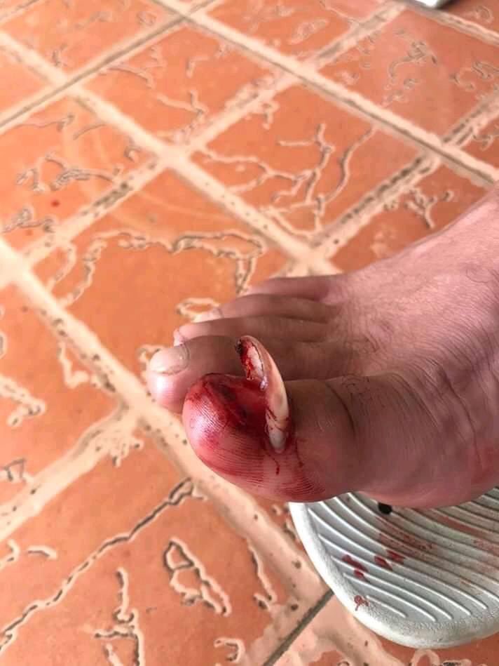 RT o mala suerte por 5 años