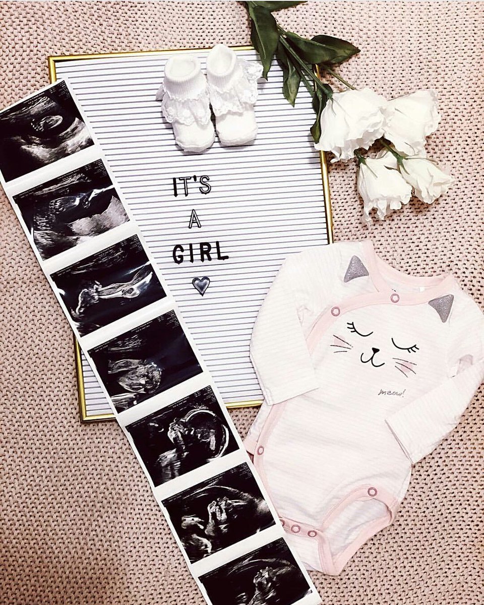 FWagsKids's tweet photo. Marcel and Franziska Halstenberg's baby is a girl 💗👶🎀
Pic: Franziska Halstenberg
#marcelhalstenberg #franziskahalstenberg #babyhalstenberg #rbleipzig #rbleipzigkids https://t.co/FGbmhmwgBm