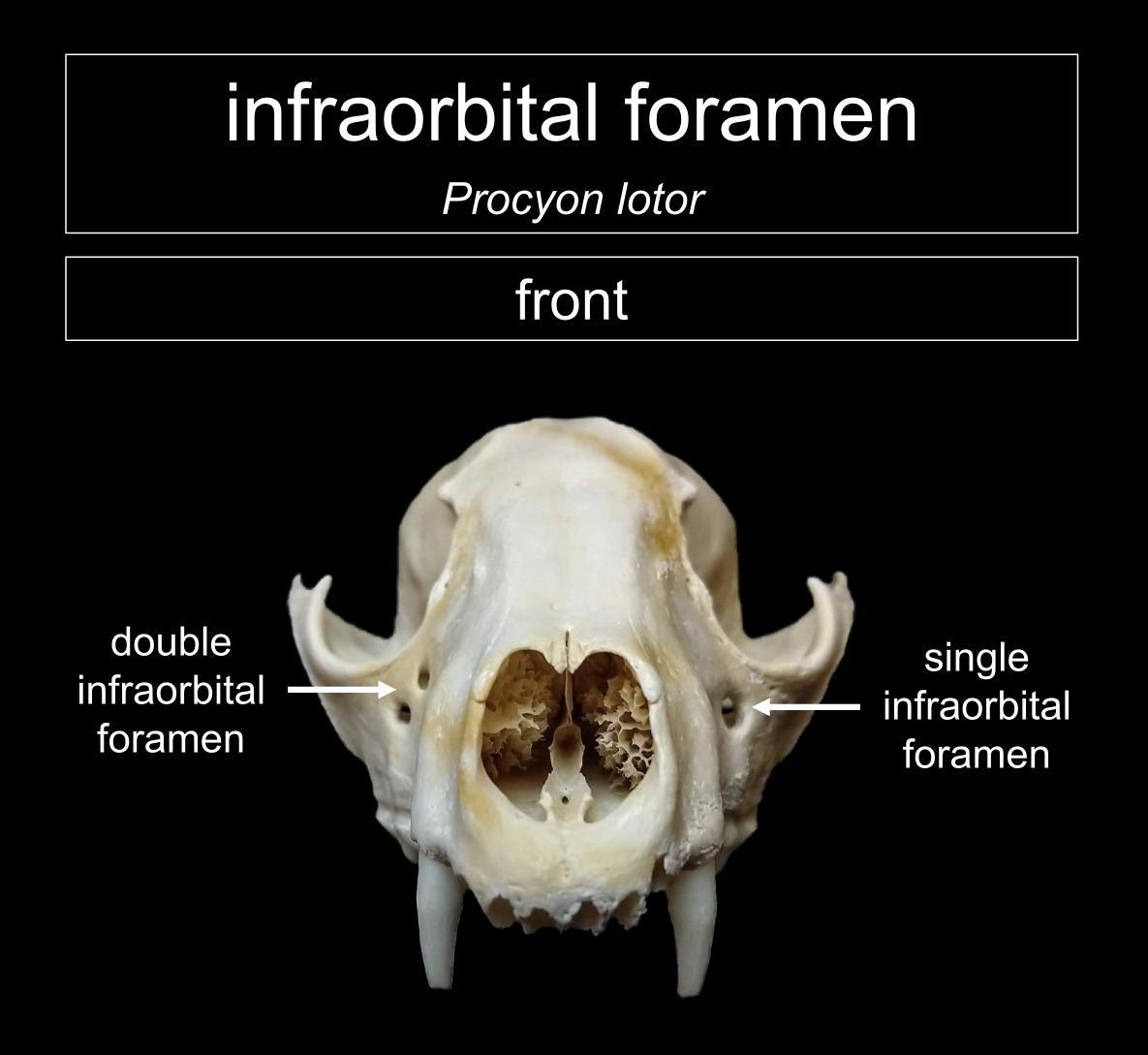 Infraorbital Foramen / Infraorbital foramen — n an opening in the