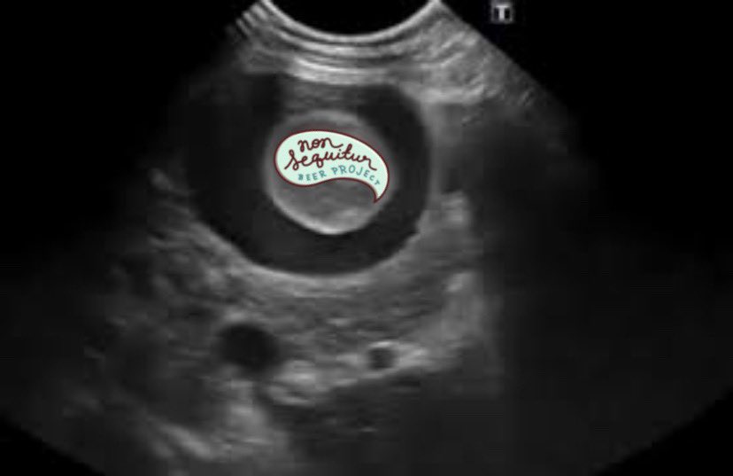 It's a brewery! 

This has been a long time coming 🥁🥁🥁But! It's! Official! Nelson and I partnered up and are launching a brewery, Non Sequitur Beer Project, coming May 2019! 

<a href="/NonSequiturBeer/">ⅭZ༝🔶­ ­В­l­­­n­­a­­­­n­­­с­e­­­</a>