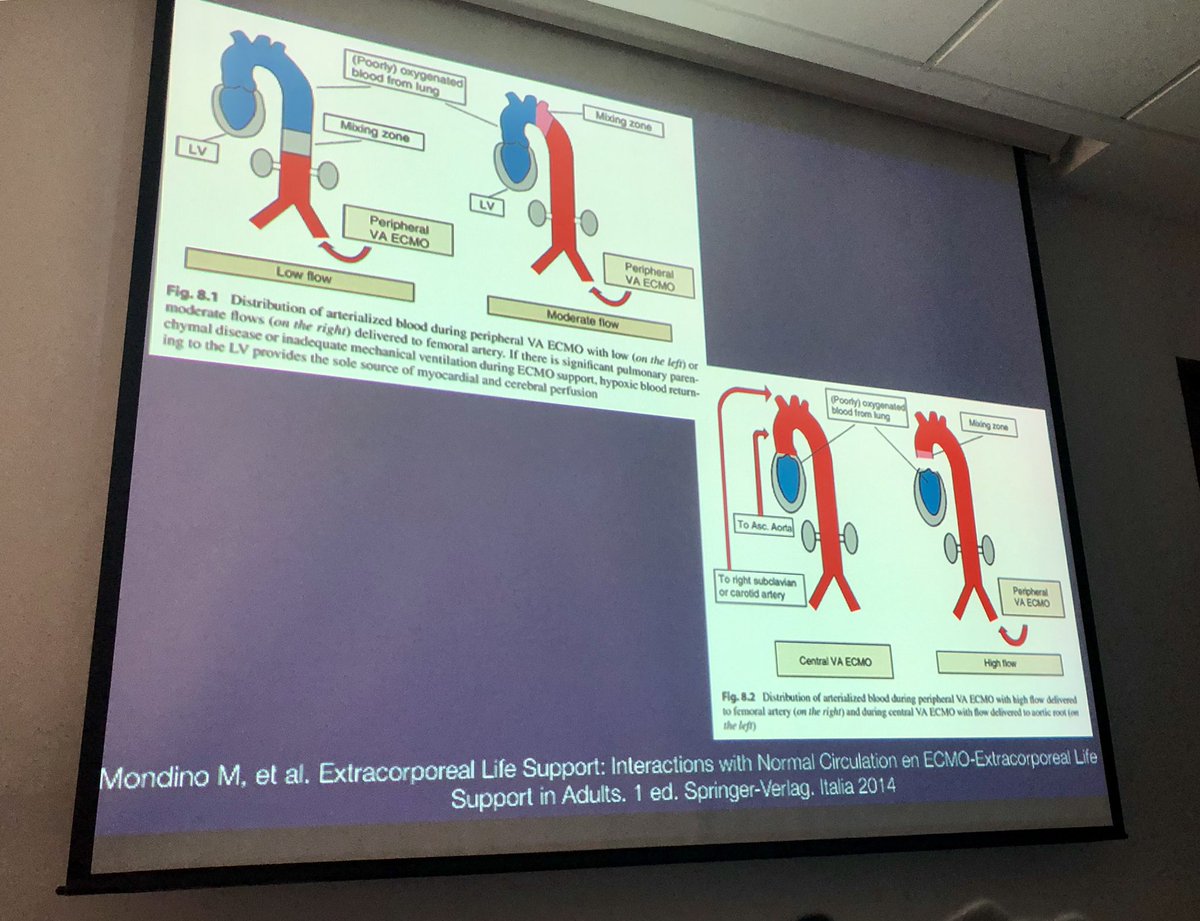eduvariCCM's tweet photo. Excelente el curso de ECMO #ELS dirigido por el profesor @MonaresTI y el equipo ECMO/ELS México en el #CeCaDa @CMDalinde Un gran esfuerzo y una terapia que estará cada vez más presente en los Cuidados Críticos. https://t.co/5tpASDdj3Z