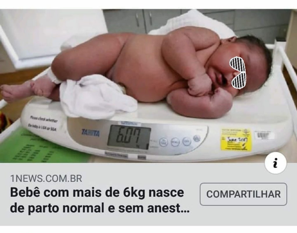 Marco Gomez Twitterissa Nace Bebe De 6 Kg Por Parto Vaginal La Macrosomia Fetal Bebe Gt 4 Kg Generalmente Se Debe A Diabetes U Obesidad De La Madre Durante El Embarazo Suele Ser Marco Gomez Twitterissa Nace Bebe De 6 Kg Por Parto Vaginal La Macrosomia Fetal Bebe Gt 4 Kg Generalmente Se Debe A Diabetes U Obesidad De La Madre Durante El Embarazo Suele Ser