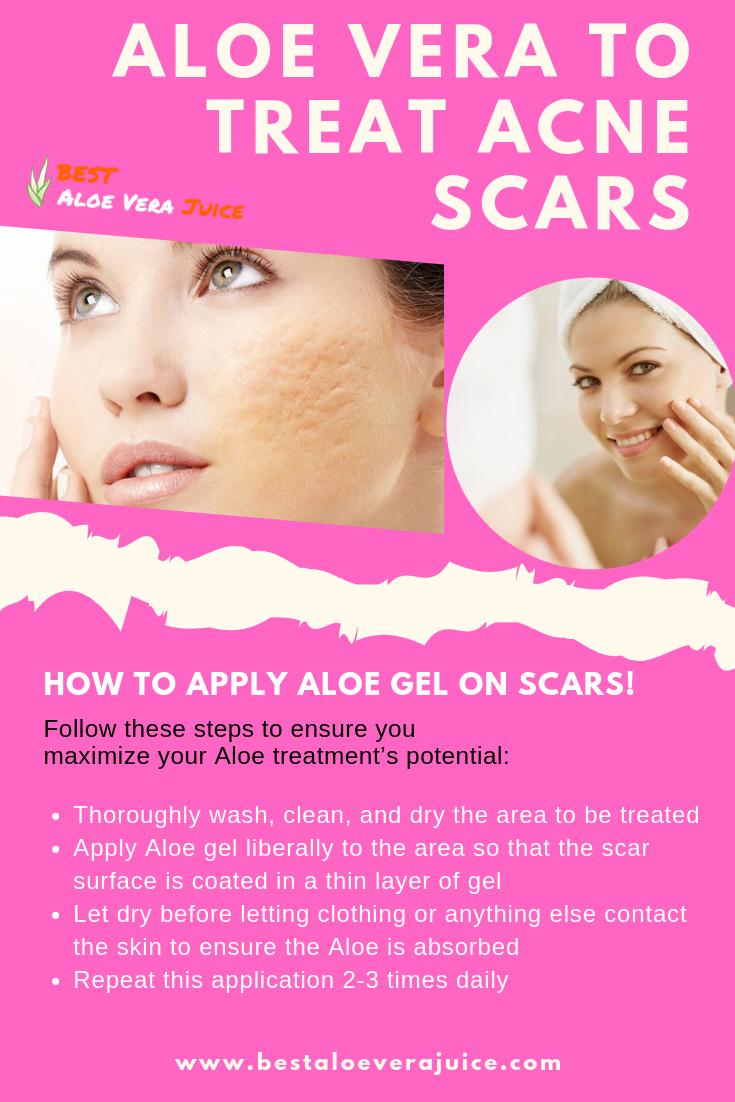 SwsPerves's tweet photo. Aloe vera to treat acne scars

https://t.co/OAz2MLgHtM https://t.co/xybwWChNyd