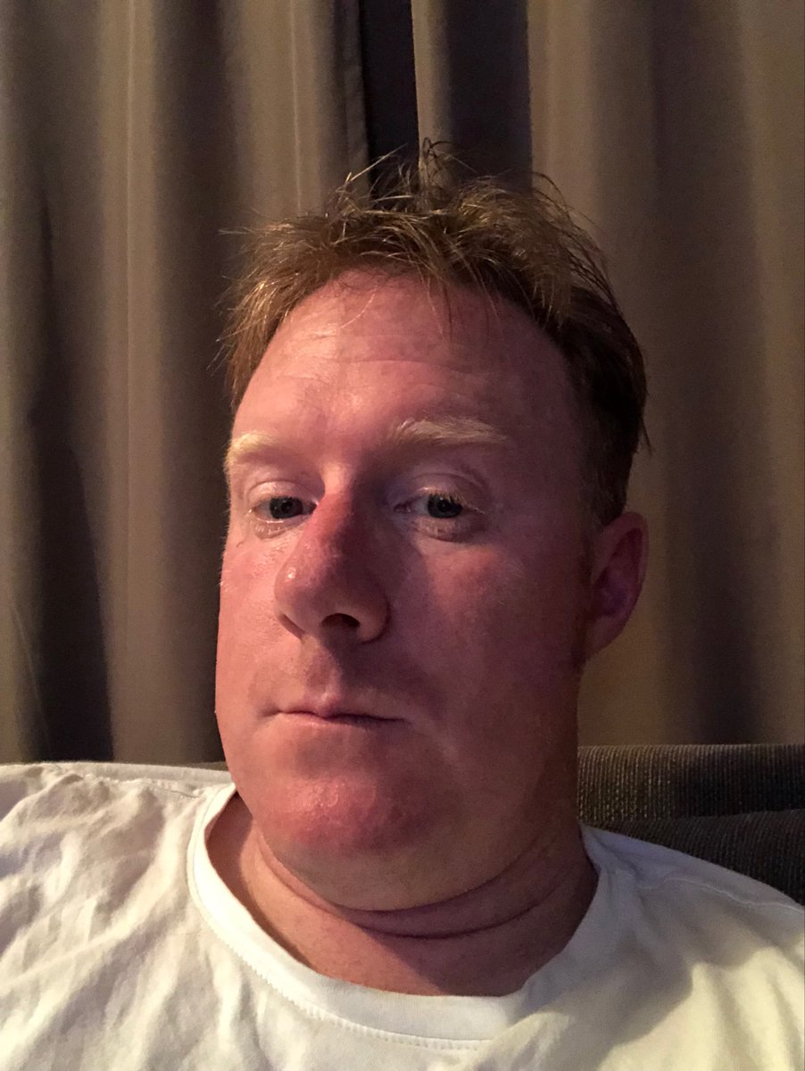 AaronPinkham's tweet photo. Played business house squash tonight. This is an hour later and I’m still putting the Pink in Pinkham! #redAF https://t.co/RiHDMT4rwV