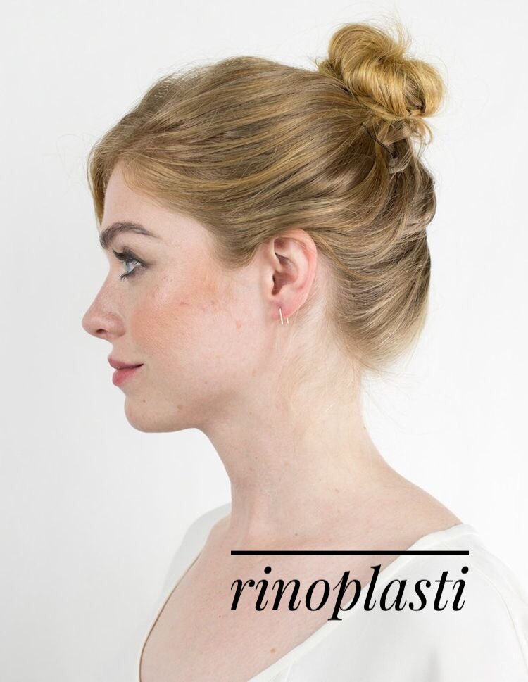 🔑 Rinoplasti ameliyatları sonrasında, 4 hafta boyunca güneş ışınlarından ve buruna zarar verecek her türlü risk faktörlerinden uzak durulması gerekmektedir.      
<a href="/ClinicSBB/">Clinic SBB</a> 
📞 02122190012 📞05325000580
#serdarborabayraktaroglu #clinicsbb #rinoplasti #burunestetiği #yüzestetiği