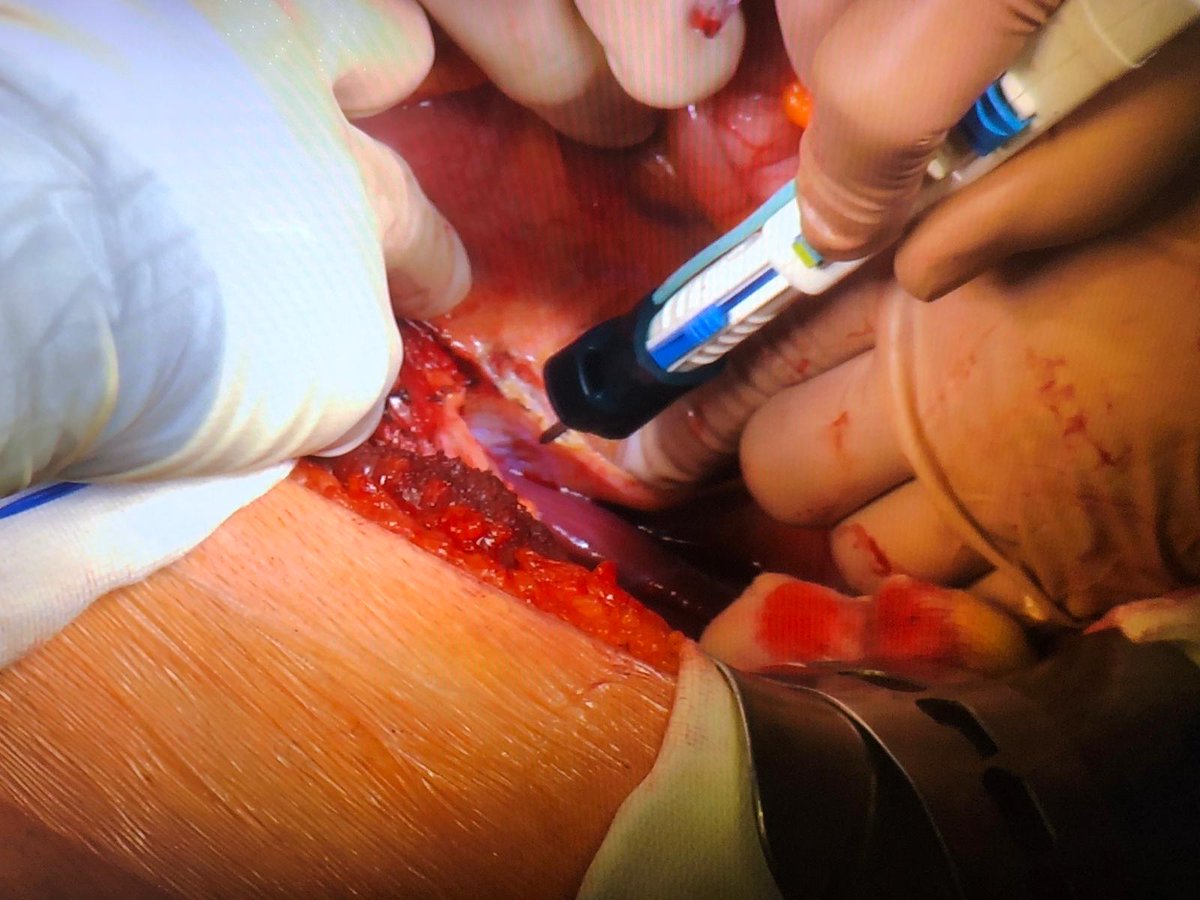 RUTILIGHT tweet media