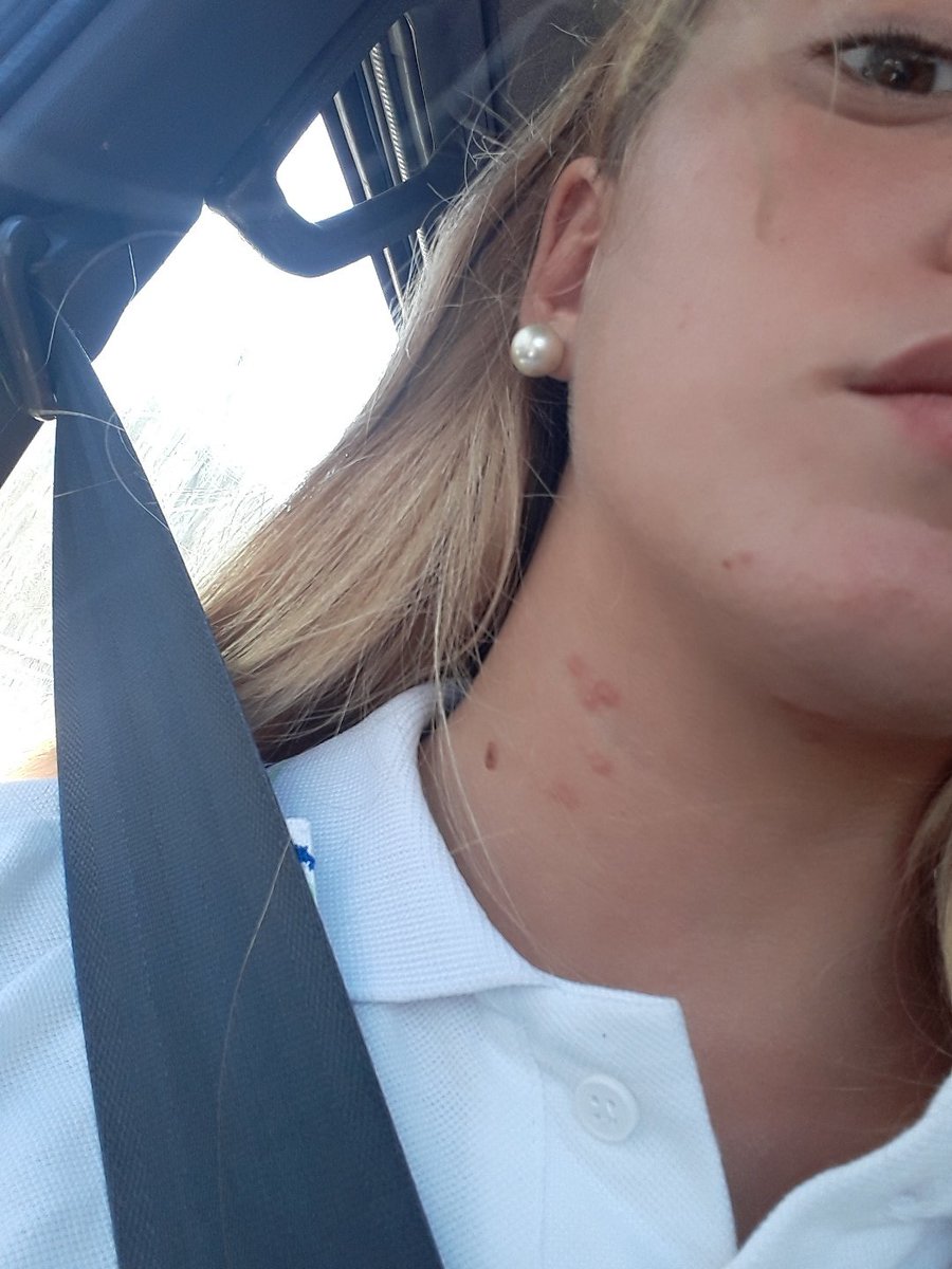 Dolopomphile's tweet photo. RT o te salen como ami🤢 https://t.co/6JYHJ1UnFu