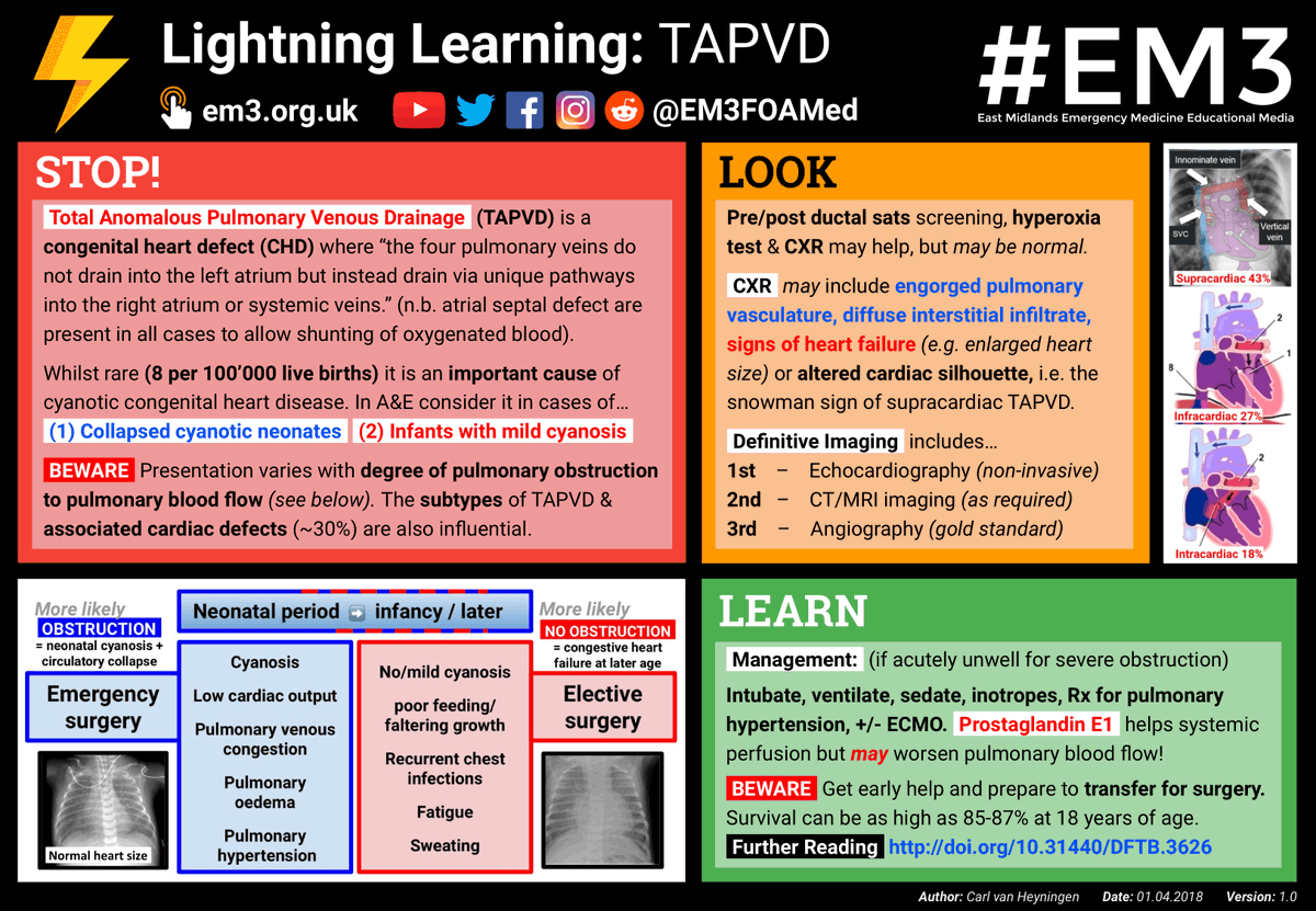 EM3FOAMed's tweet photo. Whilst #TAPVD is rare (8 in 100,000 live births) it is an important cause of cyanotic congenital heart disease. In A&amp;E consider it in cases of collapsed cyanotic neonates and infants with mild cyanosis. #LightningLearning

Related #FOAMed topics: https://t.co/49i5ALhbjT https://t.co/c0eKaXPNX9
