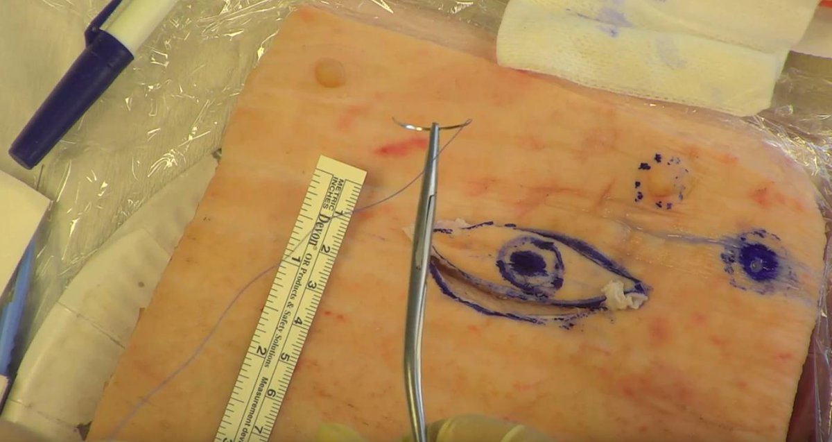 Tune in tomorrow between 2pm-4pm to view a live "teaching session snippet" from NS5057 Surgical Skills for Healthcare Practitioners - dcu.ie/sites/default/…

<a href="/DCUFSH/">DCU Science and Health</a> <a href="/ISFcharity/">IrishSkin.ie</a>

Another tweet tomorrow (before 2pm) will provide the live link.