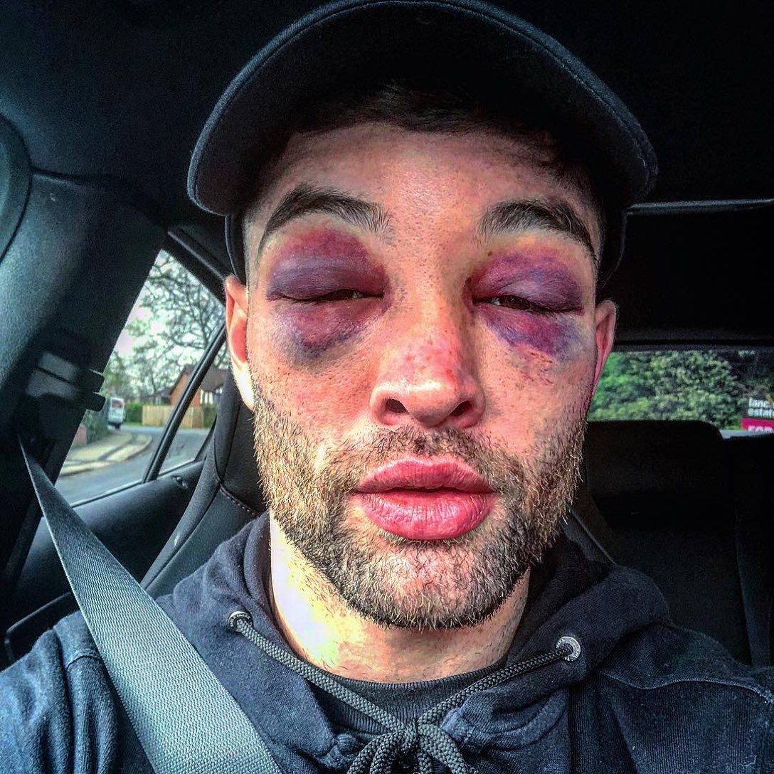 boxingcorner247's tweet photo. You don’t play boxing, 🥊 #FowlerFitzgerald https://t.co/aWazhUvBu7