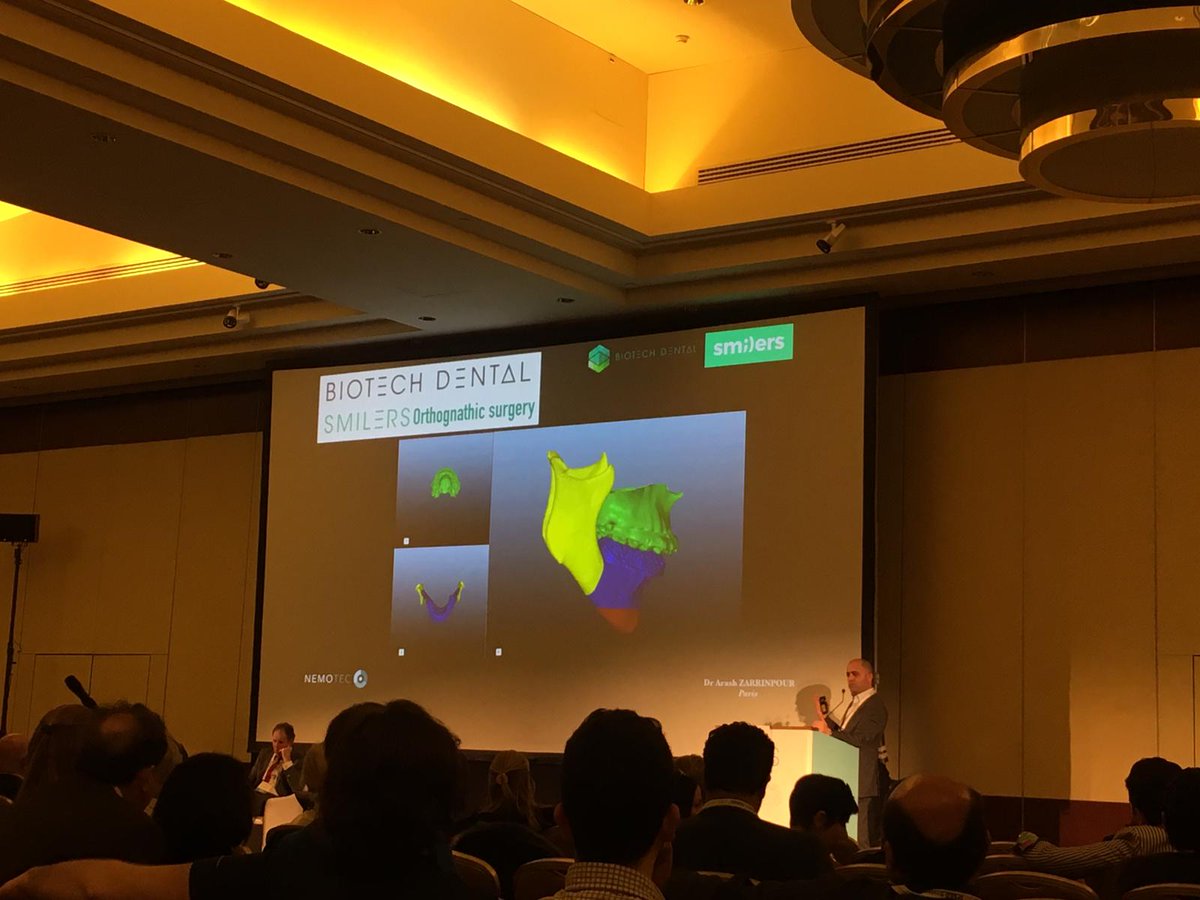Nemotec (@nemotec) on Twitter photo EUROPEAN ALIGNER SOCIETY SPRING MEETING
BIOTECH DENTAL SMILERS - Dr. Arash Zarrinpour Smilers exclusive root movement and torque control: Clinical multi-disciplinary applications; Refining and bonding techniques.
#aligner #orthodontics #biotech #nemotec #Implantology EUROPEAN ALIGNER SOCIETY SPRING MEETING
BIOTECH DENTAL SMILERS - Dr. Arash Zarrinpour Smilers exclusive root movement and torque control: Clinical multi-disciplinary applications; Refining and bonding techniques.
#aligner #orthodontics #biotech #nemotec #Implantology
