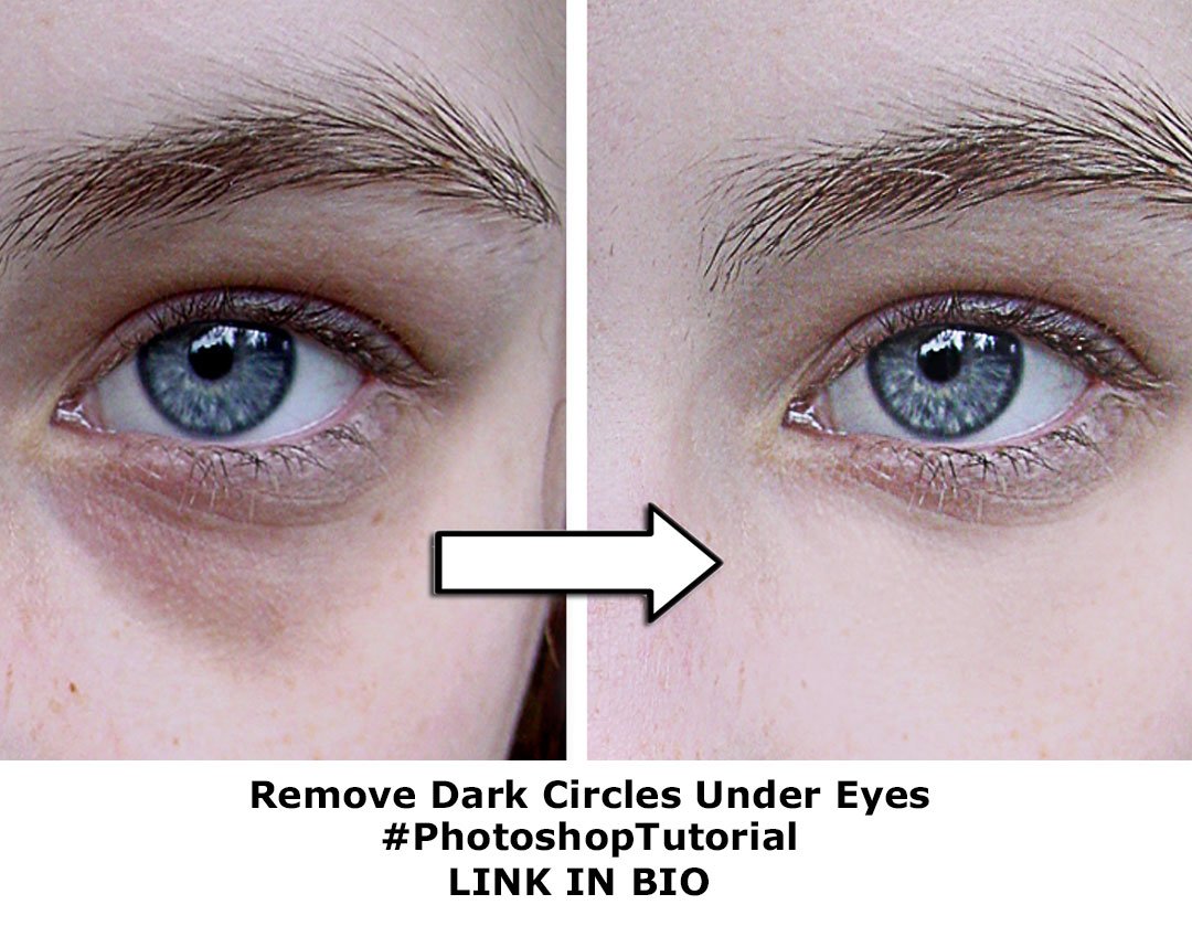PhotoshopEdit_'s tweet image. Remove dark circles under eyes | photoshop tutorial 
YouTube Link - youtube.com/watch?v=Zmy-j-…
#photoshop #eyes #eyetutorial #eyebags #darkcircles #beauty #beautytools #photoshoptutorials #photoshoptutorial #youtube #youtuber #followforfollowback #instagram #eyesurgery #retouching