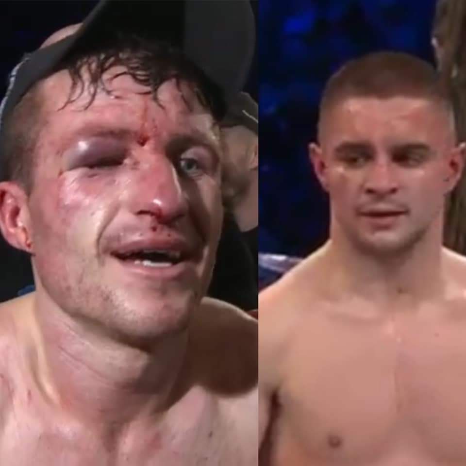 <a href="/MatchroomBoxing/">Matchroom Boxing</a> <a href="/EddieHearn/">Eddie Hearn</a> THERE MUST BE A REMATCH