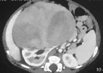 online the lung circulation pathologic physiology and therapy of diseases