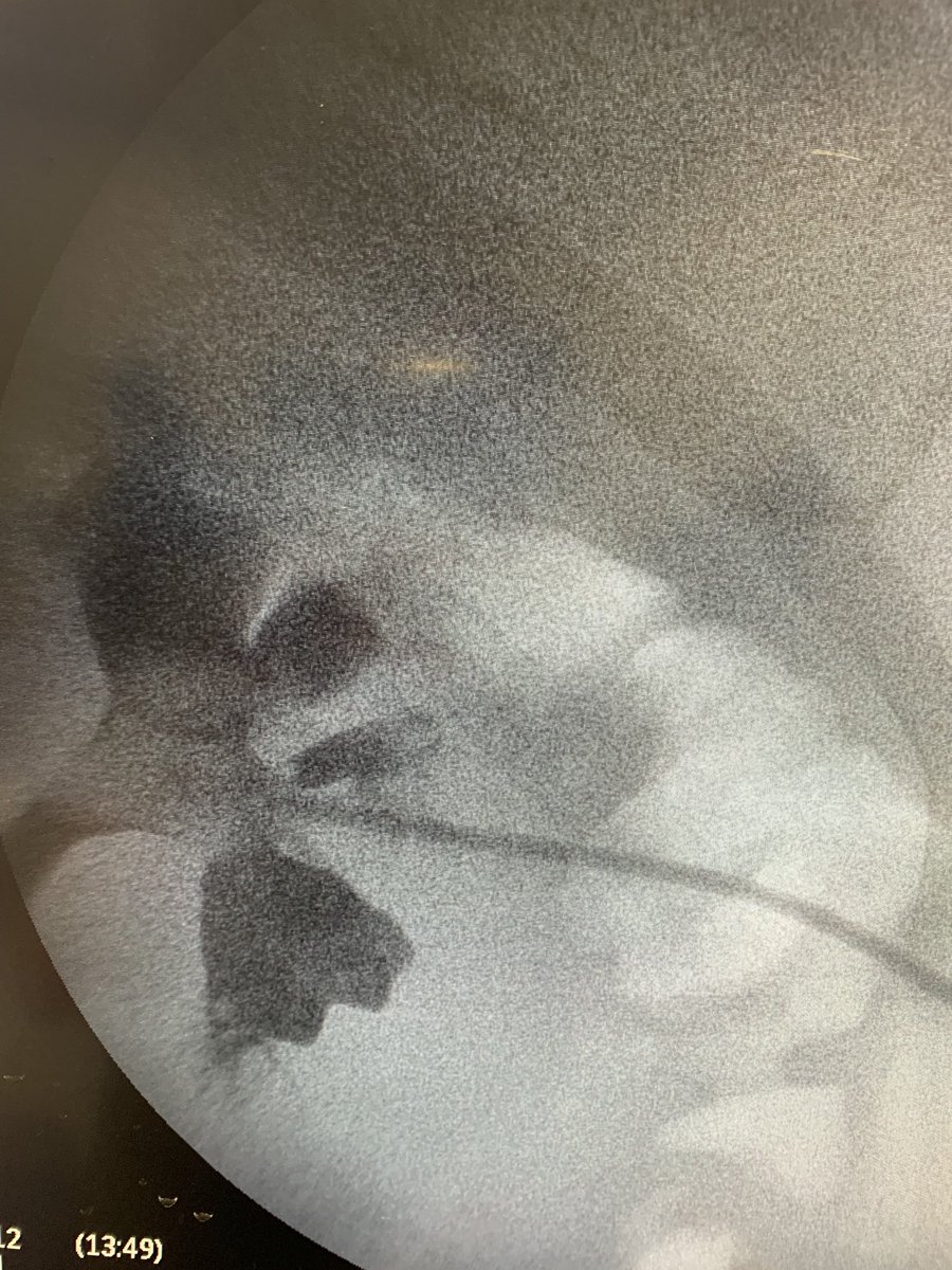 The March PERC session with <a href="/AlexHermen/">Alex Hermen</a>, <a href="/MarioMeog/">Mario Enrique Ortega</a>,<a href="/Navi_cv/">Dr. Ivan Calvo Vázquez</a> the new last year residents