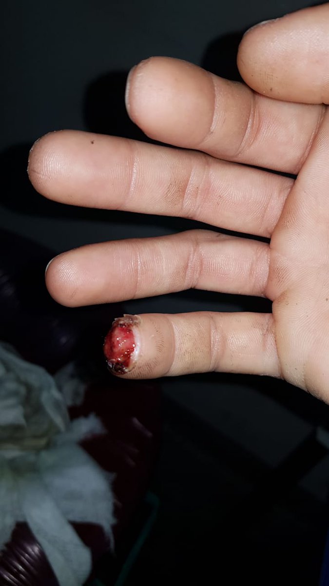 Juany48357751's tweet photo. Rt y no te cortas el dedo como mi hermano https://t.co/uqGOpXBs6o
