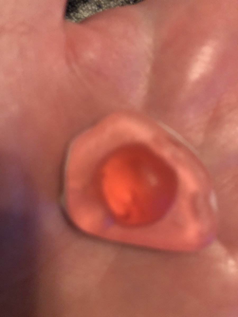 JustPerdi's tweet photo. @OfficialHARIBO 2/2 ...but NOTHING could have prepared me for this. The haribo nipple. WHAT FRESH HELL IS THIS? Questionable quality control to say the least. Kids and grownups do not need to see this and I don’t love it! https://t.co/g3idtQzwL6