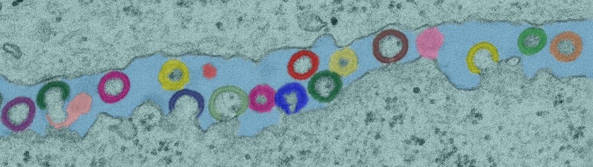 Revisiting lipid rafts: insights from viral assembly.

Check out our new study and accompanying discussion <a href="/NatureCellBio/">Nature Cell Biology</a>
👉 go.nature.com/2FPDjur and 👉 go.nature.com/2JXyPpG 

-<a href="/PrabsSengupta/">Prabuddha Sengupta</a>