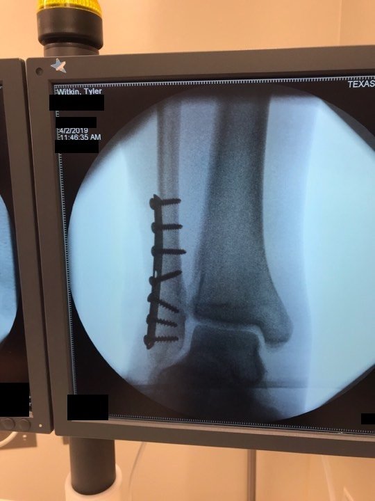 Tyler Witkin tweet media