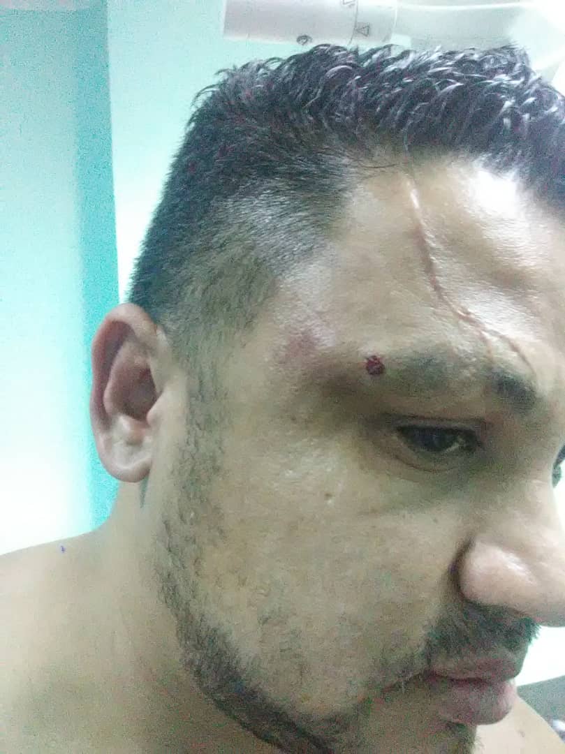 AlbanoGonzalo's tweet photo. #Cojedes. Denuncian agresión física al Dr Próspero González Jefe del Servicio de Traumatología del Hospital Dr Egor Nucete de San Carlos, miembros de colectivos habrían sido los agresores. #Cojedes #SanCarlos. #2Abr #Venezuela. https://t.co/YD1rVQkynk