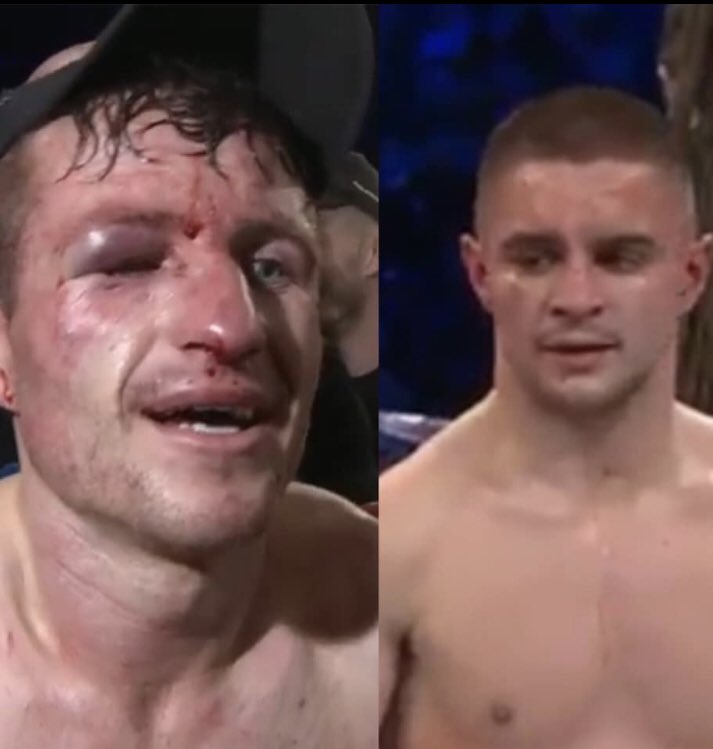 This picture paints a thousand words and shows that Joe Hughes should get a rematch. <a href="/EddieHearn/">Eddie Hearn</a> <a href="/MatchroomBoxing/">Matchroom Boxing</a>