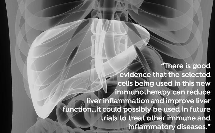 BHPComms's tweet photo. New treatment for chronic #liverdisease is on the horizon - researchers at @immunologyUoB &amp; @uhbtrust are trialling the use of new #immunotherapy techniques, in partnership with @Orbsen Therapeutics >
https://t.co/iNYZ2wD6Yu
#whywedoresearch #iamresearch #cholangitis #hepatitis https://t.co/kypzORxMB9