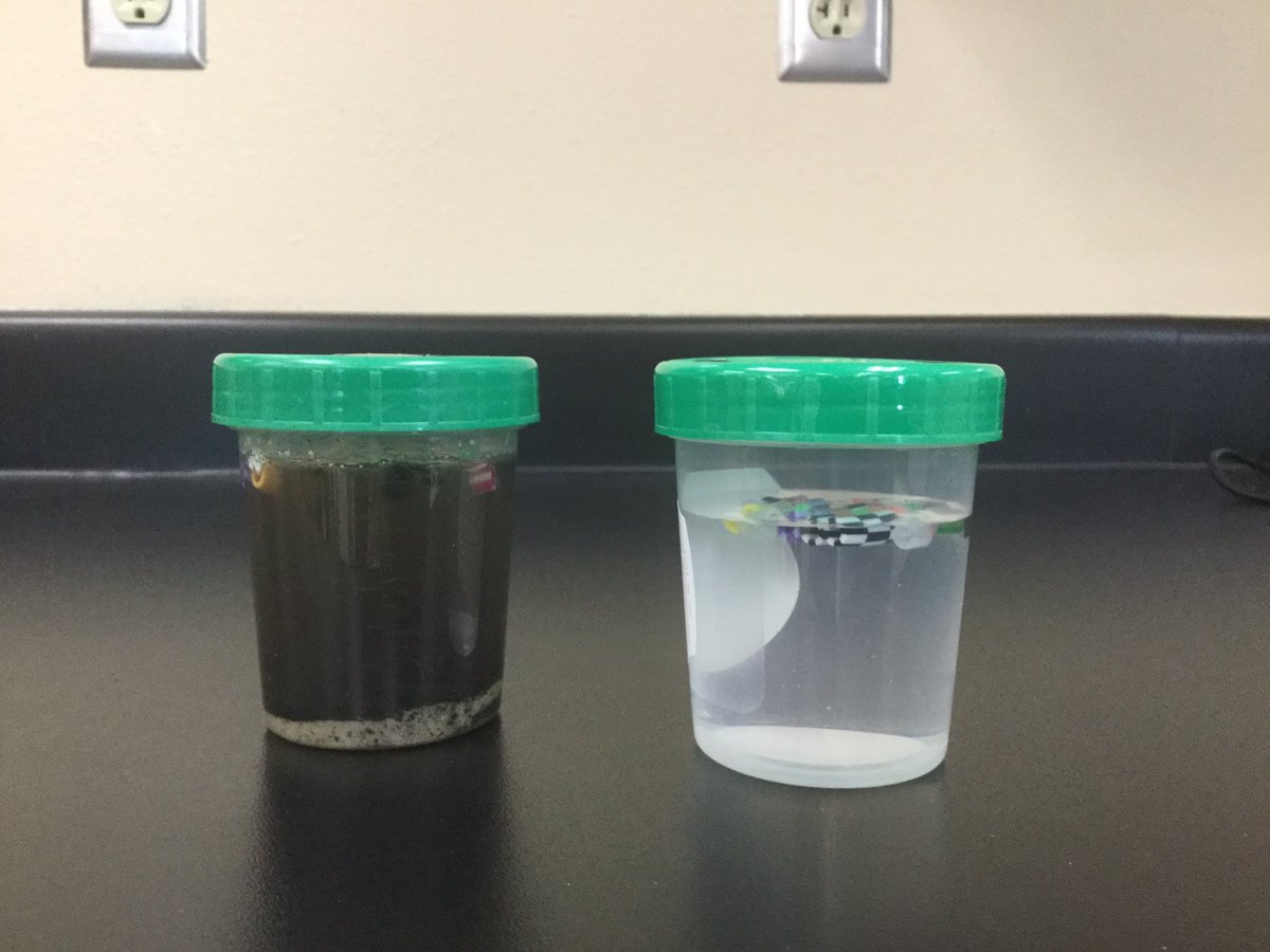 thebluetrooper's tweet photo. How does a kidney function #stemlab #HMSSIOP #HuronTigers https://t.co/CY7tObFnf3
