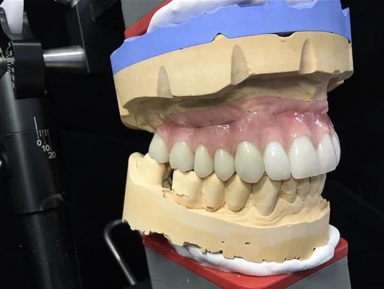 SESİMİZİ DUYURACAĞIZ..
HAKKIMIZI ALACAĞIZ. 🛑🛑@RT_Erdogan <a href="/drfahrettinkoca/">Dr. Fahrettin Koca</a> <a href="/saglikbakanligi/">T.C. Sağlık Bakanlığı</a>