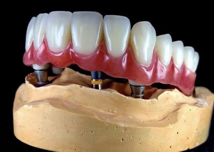 KEŞKE ATAMALARDA OLAN KADRO BUNALIMINI VE DOLU BÖLÜMLERE GÖRE DİPLOMA VERMEYİ DE ERKEN TEŞHİS EDİLSEYDİ.. @RT_Erdogan <a href="/drfahrettinkoca/">Dr. Fahrettin Koca</a> <a href="/saglikbakanligi/">T.C. Sağlık Bakanlığı</a> #ErkenTeşhisHayatKurtarır