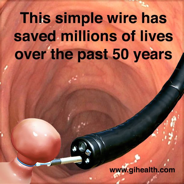 HealthDigestive's tweet image. The war on #coloncancer began 50 years ago when it was learned that finding and removing #colonpolyps could effectively #PREVENTCANCER    bit.ly/2OGCbwe