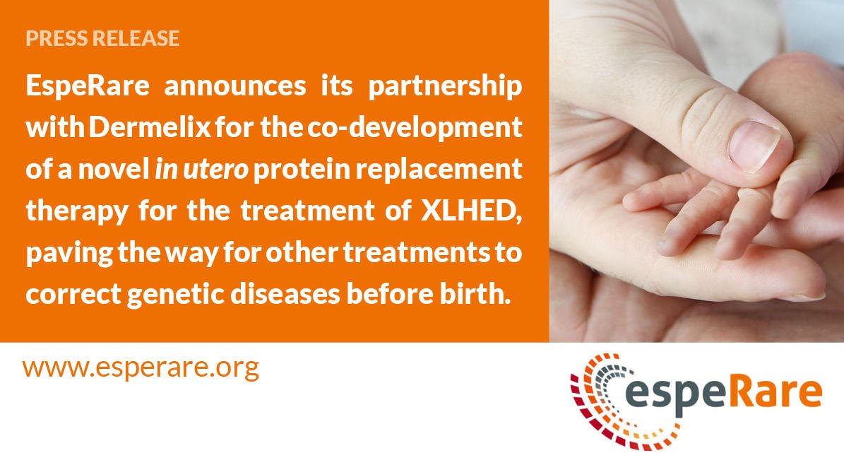 EspeRare partnership with Dermelix to create a potential treatment for XLinked Hypohidrotic Ectodermal Dysplasia