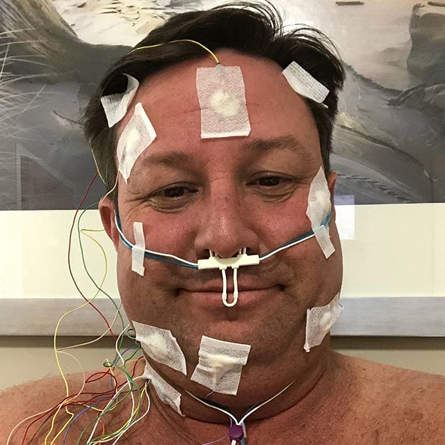 djbrianpate's tweet image. Nurse: “Ok Mr. Pate, you are all wired up for your #sleepstudy. Now we just need you to relax and sleep normally.” Me: “Really?” #sleepstudyselfie #sleepstudytest #sleepy ift.tt/2Vnk2G0