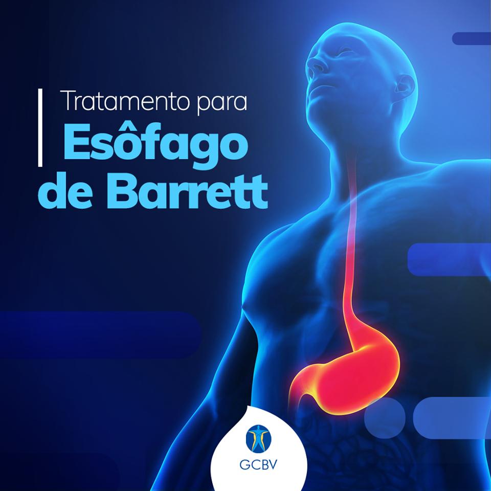 ClinicaConcon's tweet photo. Você já ouviu falar no Esôfago de Barrett? Trata-se de um tipo de lesão causada pelos episódios constantes do Refluxo Gastroesofágico e que pode levar o paciente ao desenvolvimento de câncer. Saiba mais:  https://t.co/aSl38RwkF6 #Valinhos #EsofagodeBarret https://t.co/a1sxnV7qUH