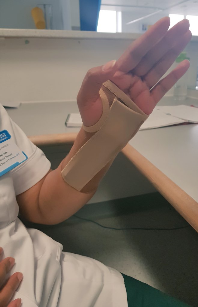 Dinuli15's tweet photo. In awe of the power of Hand Splints in how they can bring amazing impact and results to individuals from one day to the next! #occupationaltherapy #ValueOfOT #ListerHospital #handsplints #splints #splinting #HandTherapy https://t.co/kYISNeJfj9